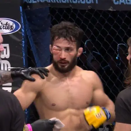 Fighter May Have Suffered Worst Swollen Eye Ever